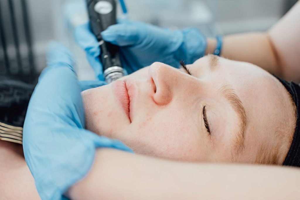 Bared Monkey Laser Spa